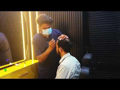 HAIR TRANSPLANT: STARTING A NEW LIFE