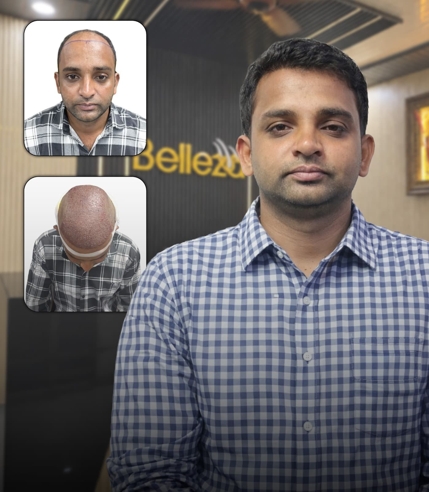 A New Hairline, A New Confidence