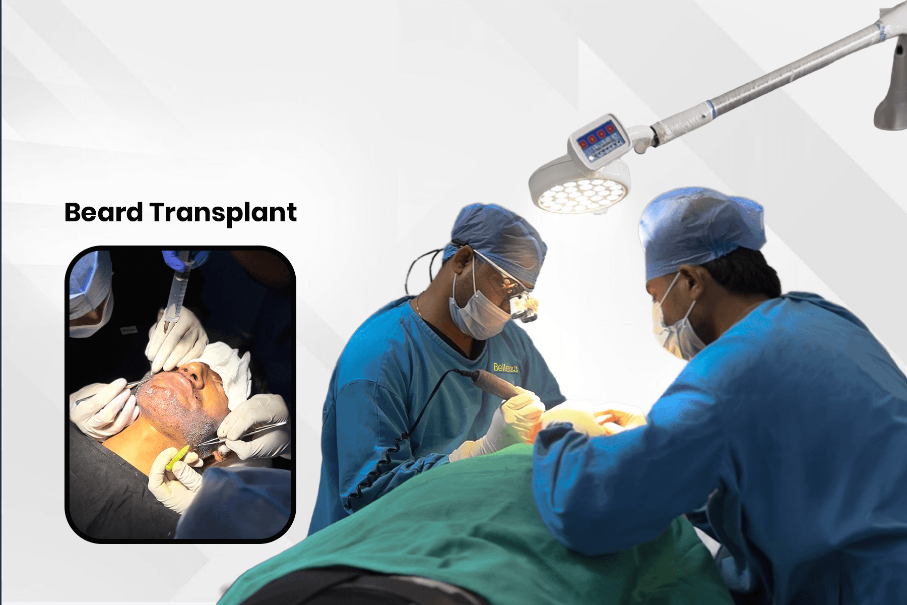  Best Beard Transplant Clinic in Delhi | Cost & Results