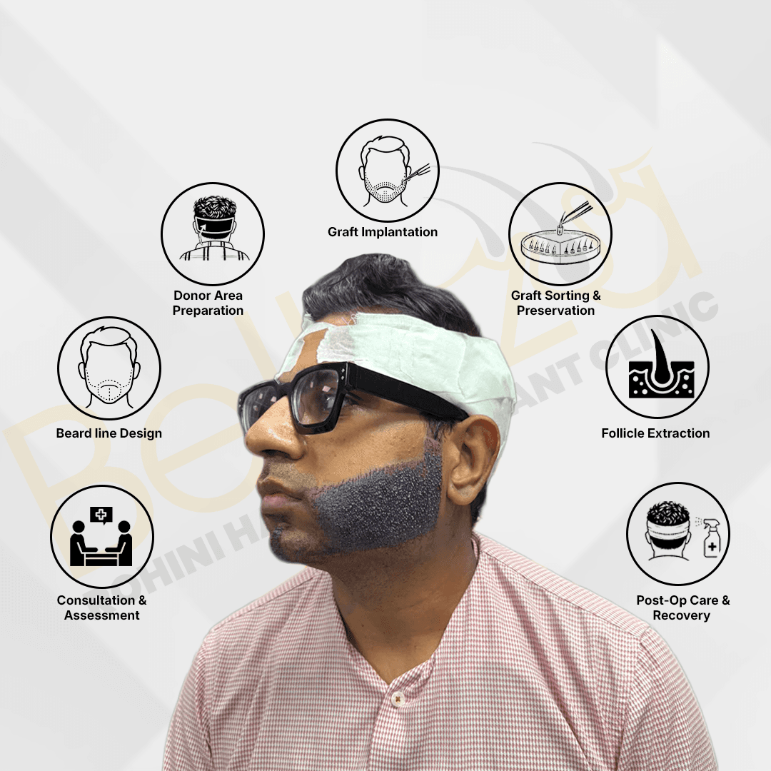 Hair Transplant Process Illustration