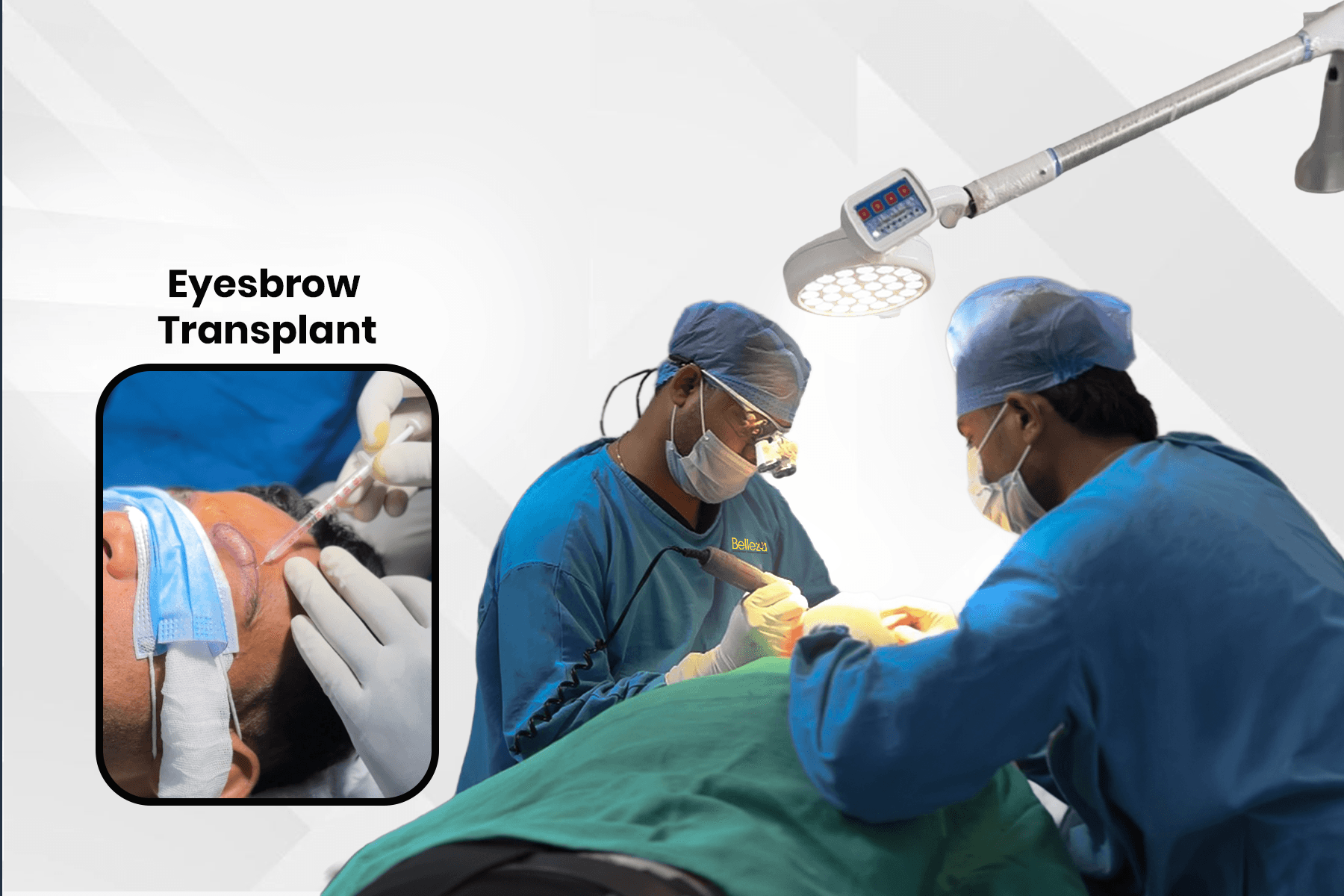 Eyebrow Transplant in Delhi | Cost, Results & Clinic